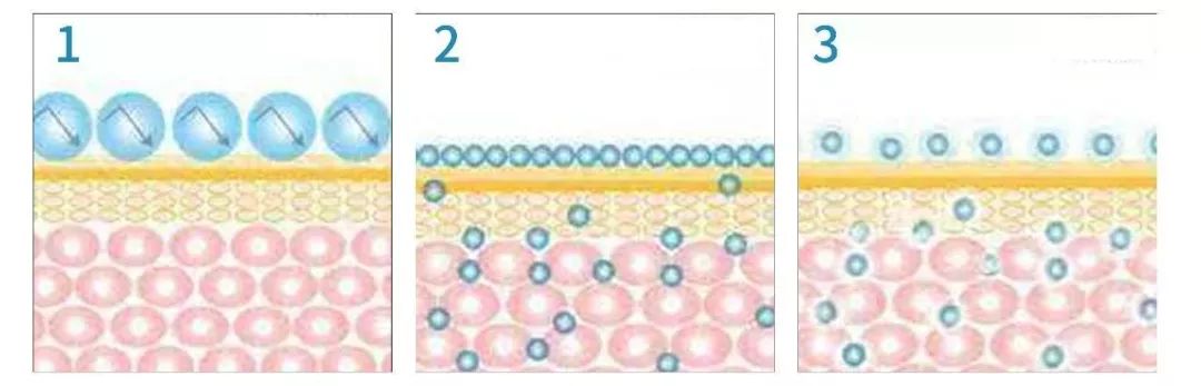 湿疹晒伤后抹什么药膏,日晒皮炎湿疹用什么止痒