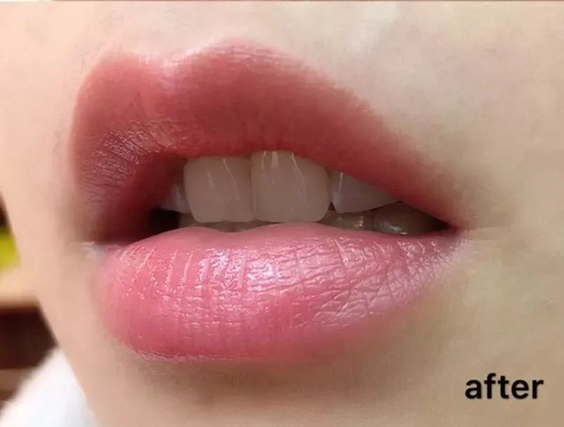 现在最好的脱毛产品,夏季脱毛都什么价位