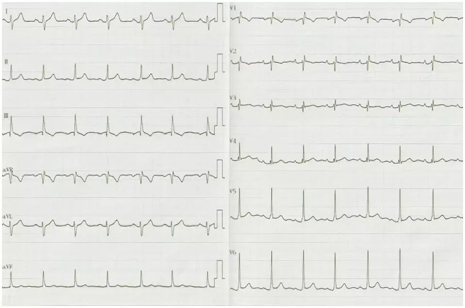 心动在线怎么没有了,心动在线观看