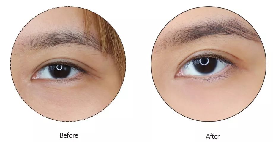 淡化眼纹的眼霜推荐哪款,一款真正淡眼纹的眼霜