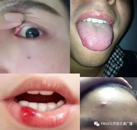 春季养生清肝食物大全图片,春天清肝火明目的食物