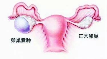 妇幼保健院可以看囊肿吗,妇幼门诊科普