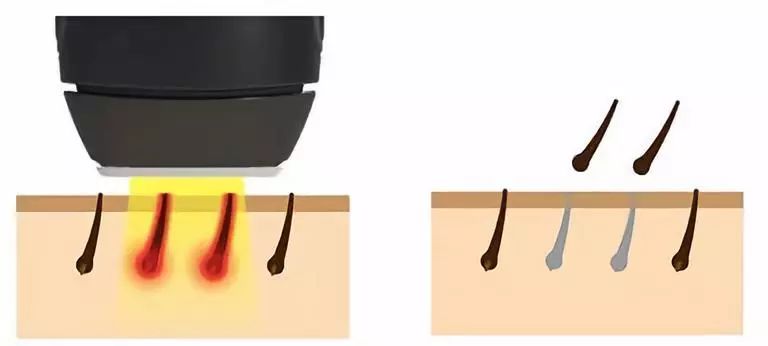 让我在你的肌肤上滑行，抚平每一个毛孔