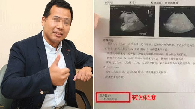 小心肝护肝茶有用吗,小心肝茶叶是什么茶