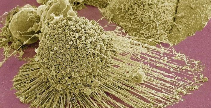 她拥有永生,靠此造福10亿人,死于癌症后,她的细胞带她重生!