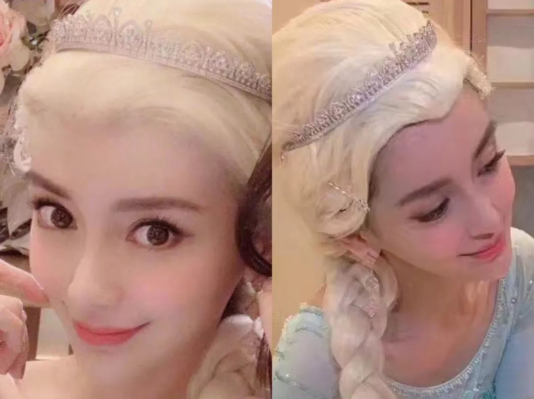 美容针真的可以祛法令纹吗,10块钱不到的成本去法令纹去皱