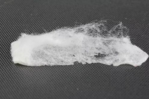 眉间纹抬头纹祛皱效果好吗,祛皱淡纹美容院