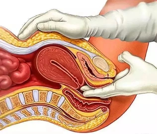 三年一做的妇科检查,今年妇科检查几月份开始检查