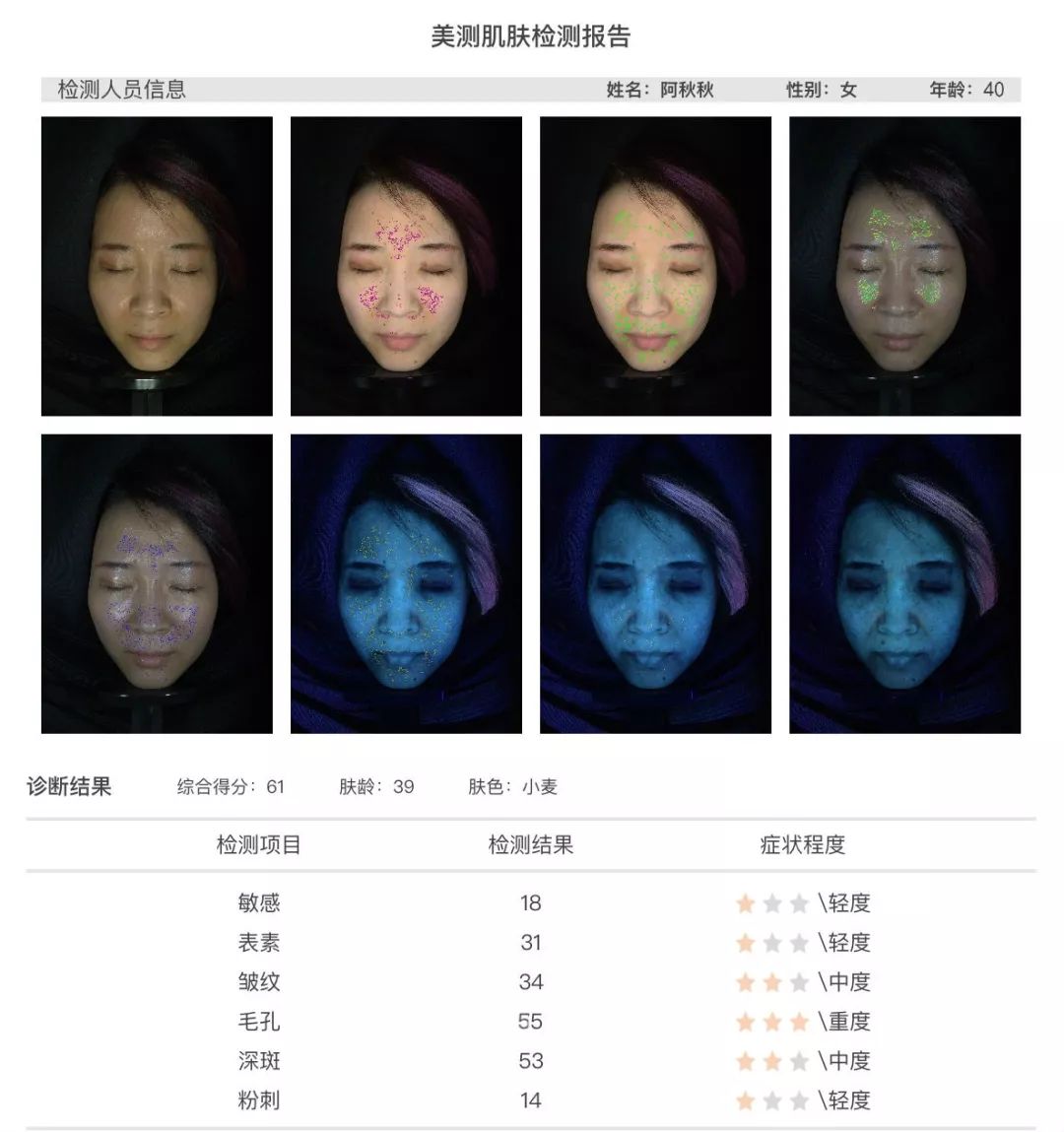 小茂肌诊室到底有多强,小茂肌诊室皮肤状态