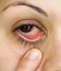 姑娘我看你印堂发黑下一句,姑娘我看你印堂发黑