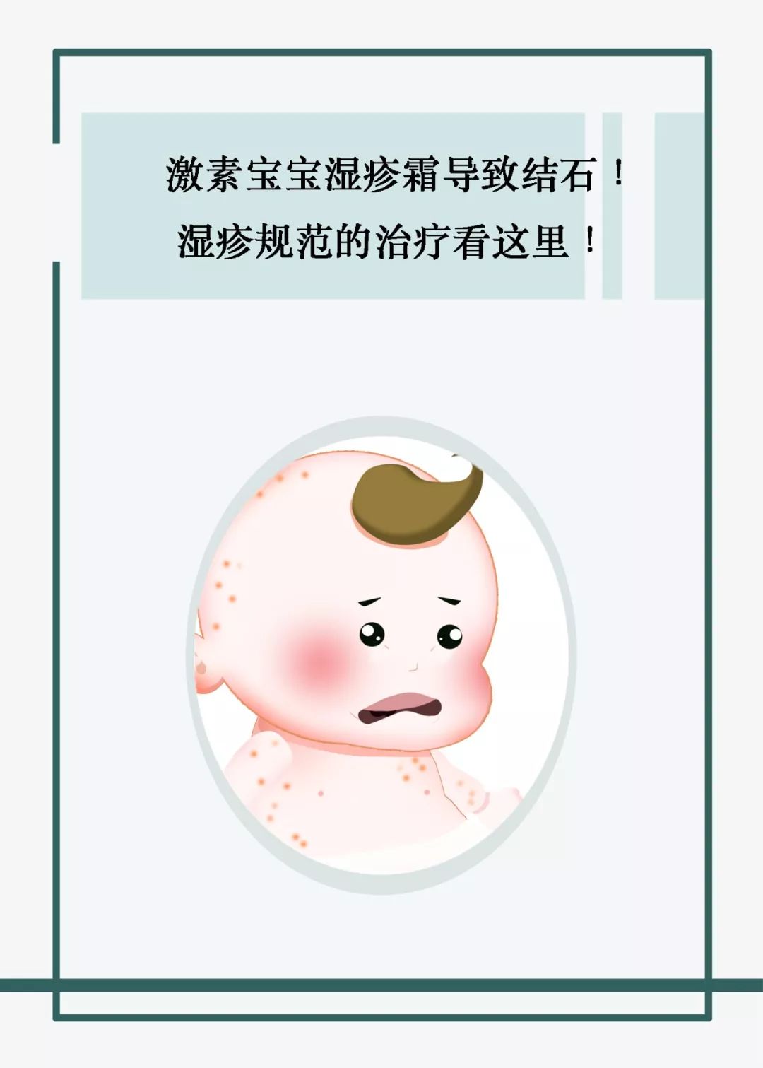 宝宝湿疹使用激素的方法,宝宝湿疹用激素的后遗症