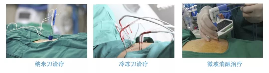 “冷冻”入“港”？复大已有十六年过万例治疗经验