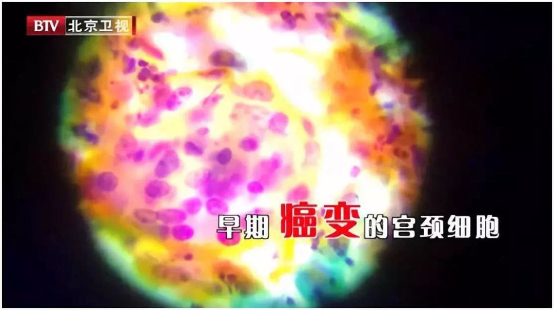 乳腺癌宫颈癌哪个严重,女性乳腺癌宫颈癌哪个发病率高