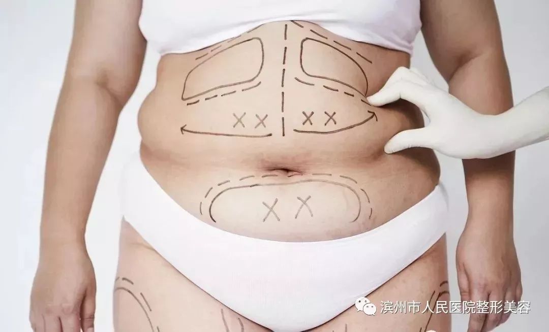 不用节食也可以暴瘦身体,不用节食还能瘦的神器