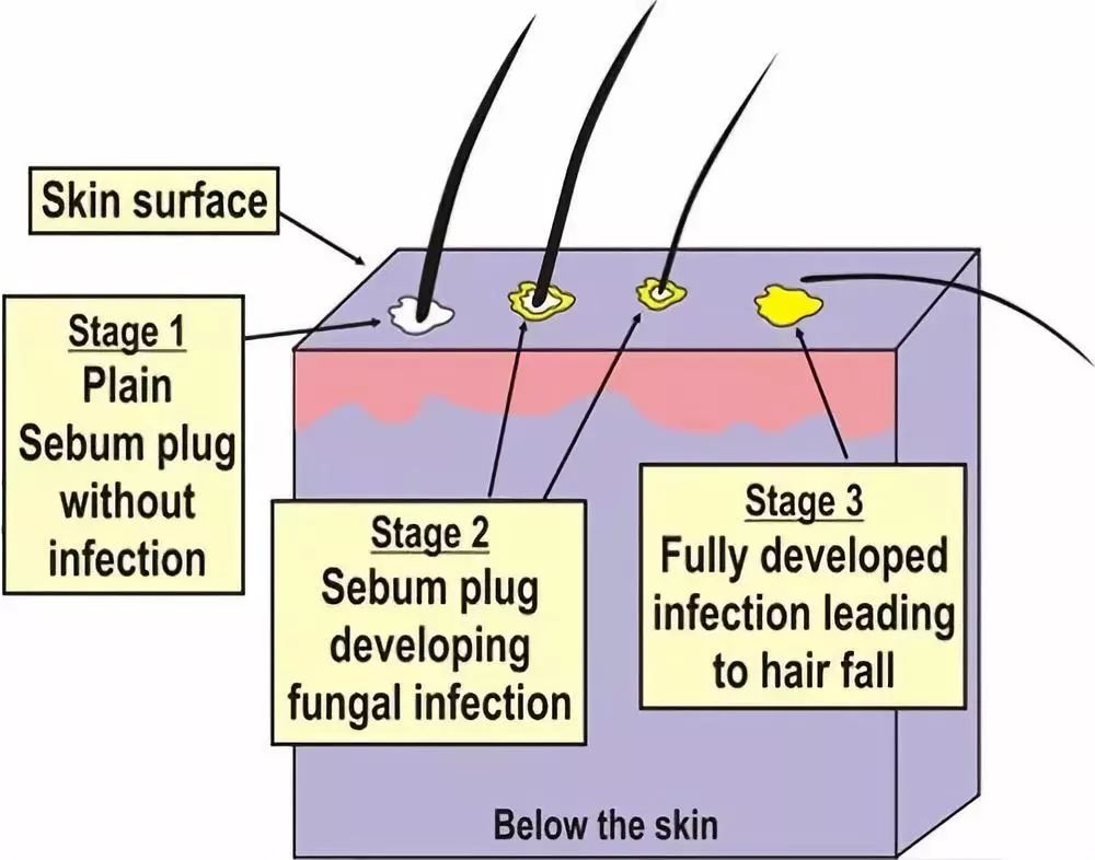 新西兰高端沙龙专用，2秒1喷，增发从“根”开始