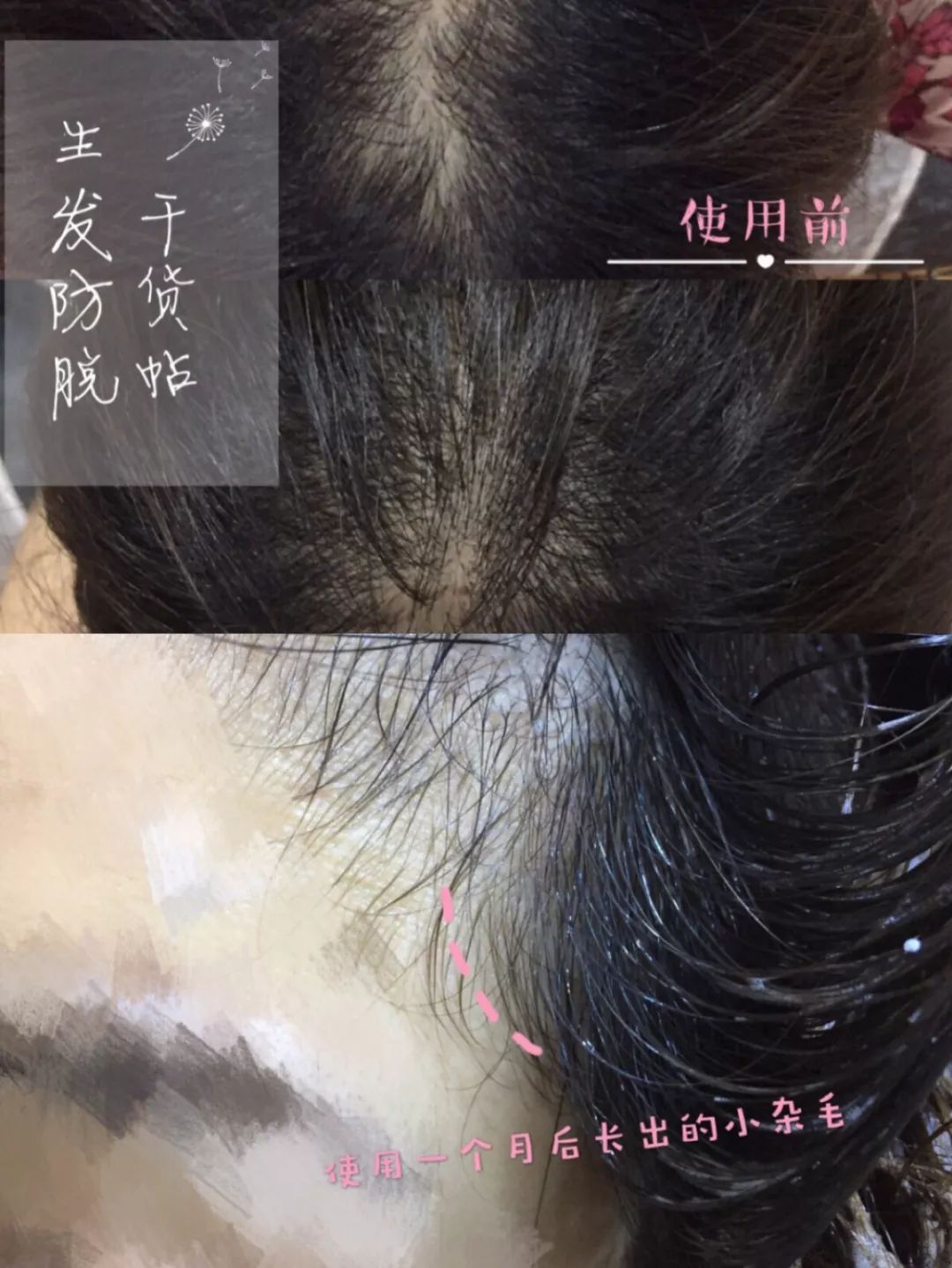 新西兰高端沙龙专用，2秒1喷，增发从“根”开始