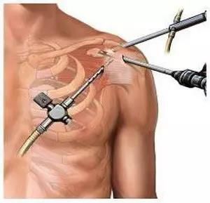 内固定取出诊疗指南,取内固定中医病历模板