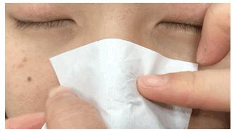 白头黑头到底拔不拔,黑头反反复复如何根治