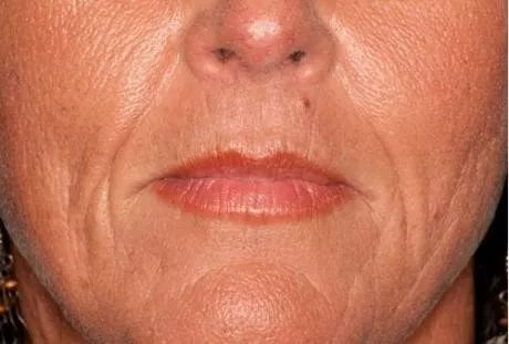 发了一张自拍给男朋友,给相亲对象发照片要不要开美颜