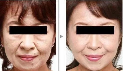 发了一张自拍给男朋友,给相亲对象发照片要不要开美颜