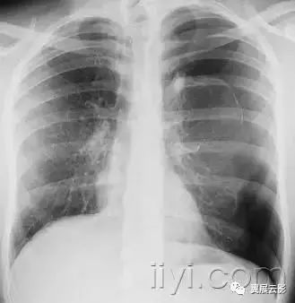 胸部解剖及常见疾病影像表现,胸部影像学基础知识