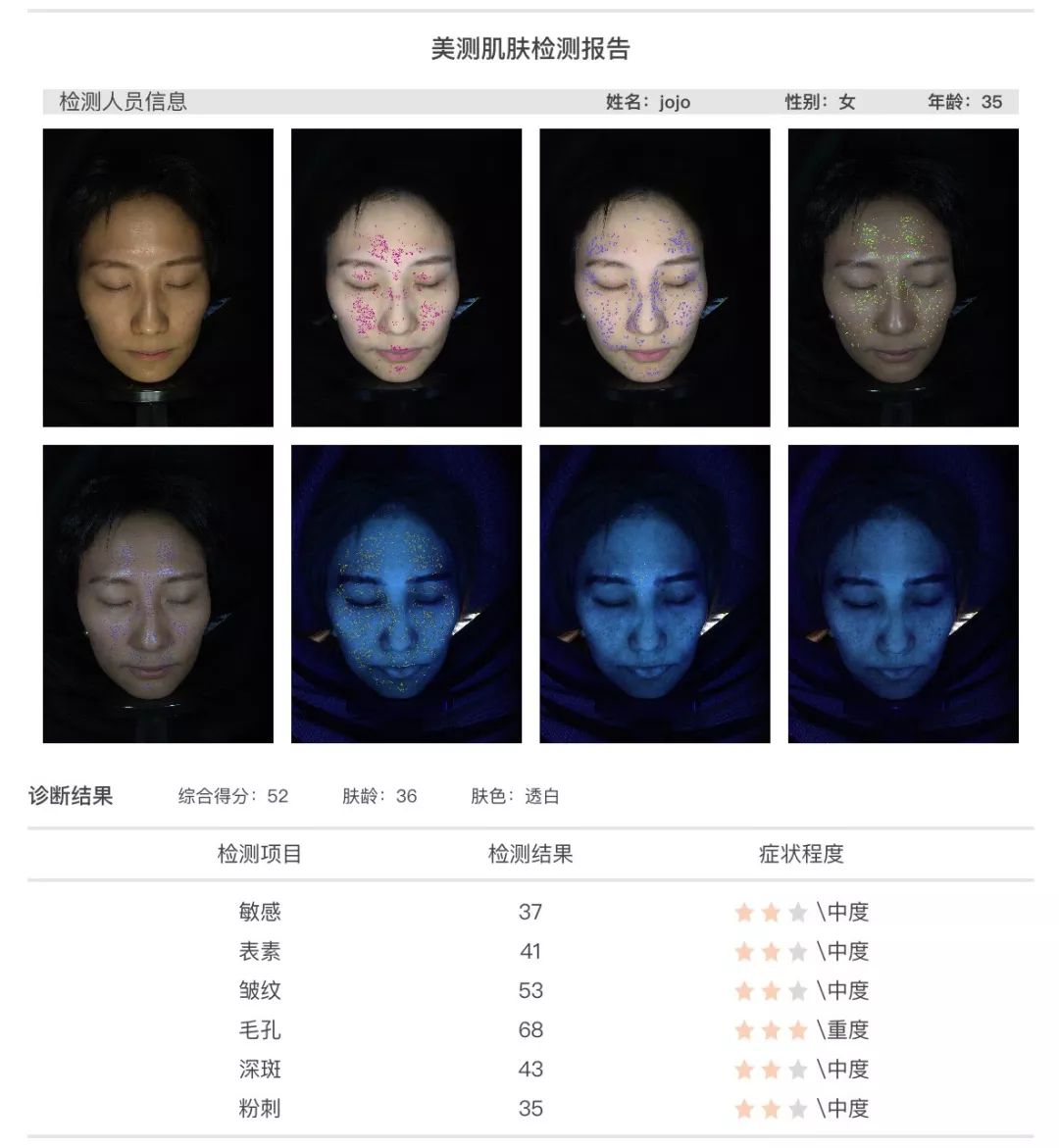 小茂肌诊室∣为什么拼命补水好多年,皮肤还是没变好?