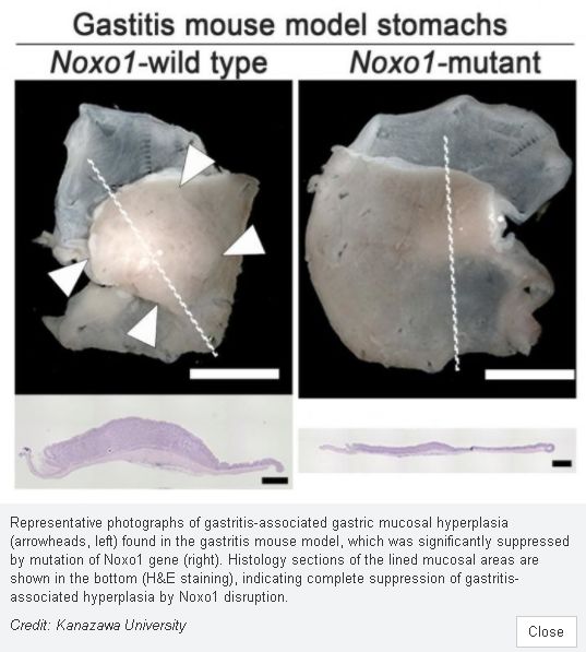 免疫靶向能治疗癌栓吗,微卫星稳定型直肠癌免疫治疗