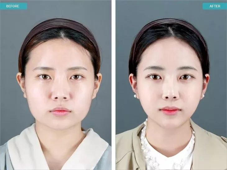 【精选好物】滚一滚，全身缩水小一圈！明星都爱的淋巴按摩仪，滚出小蛮腰、小V脸