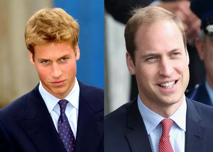 现在市场上脱发育发露有效果吗,防脱育发露对雄激素脱发有效果吗