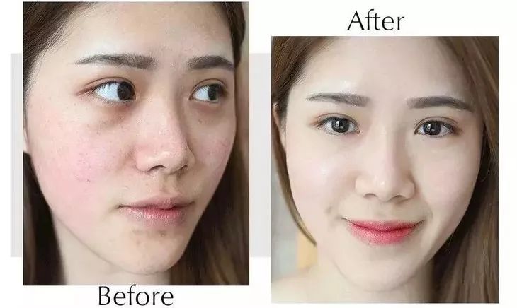 螨虫在脸上爬好不好,螨虫爬过的东西还能用吗