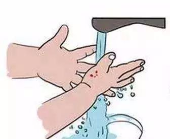 被咬伤感染狂犬病的概率,狂犬病和破伤风的表现有何不同