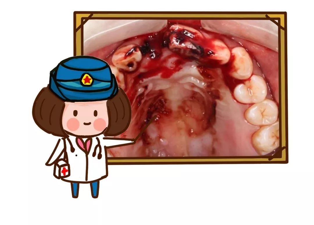 牙外伤序列治疗,军医出现医疗事故会怎么处理