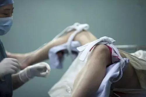 妇科医生手术中途涨价,女性做人流手术被加价