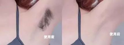 有什么办法脱毛之后不再长,怎样脱毛不再长最有效方法