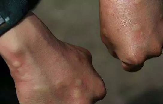 这居然是灭蚊灯？纯物理灭蚊，无毒无味，孕妇孩子都可用