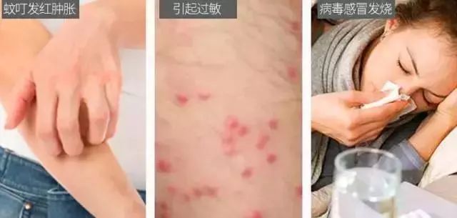 这居然是灭蚊灯？纯物理灭蚊，无毒无味，孕妇孩子都可用