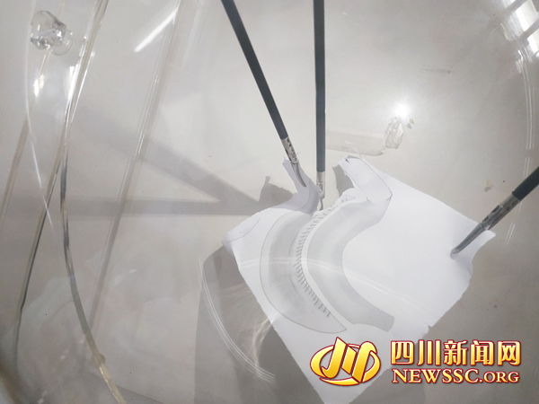 中国第一胖600多斤减肥到200斤,中国第一胖减肥成功一年减了400斤