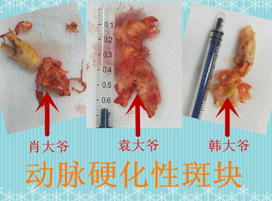 做了这个手术，肖大爷的白发变黑了……