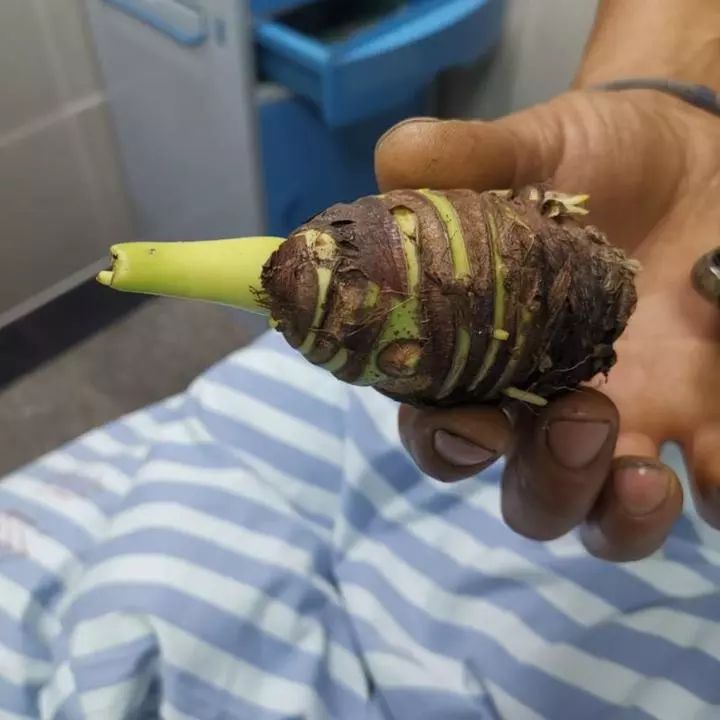 台州人注意！碰了一下就中毒，严重者可致命！这个毒物很多人家里有