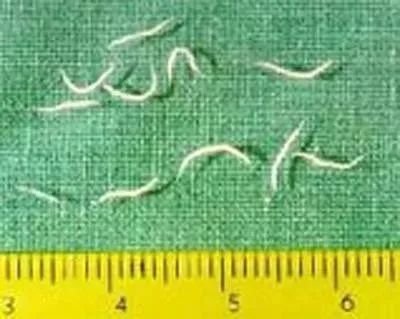 惊!长春高二女生头上洗出数条1厘米长白虫子!这个习惯你有吗?