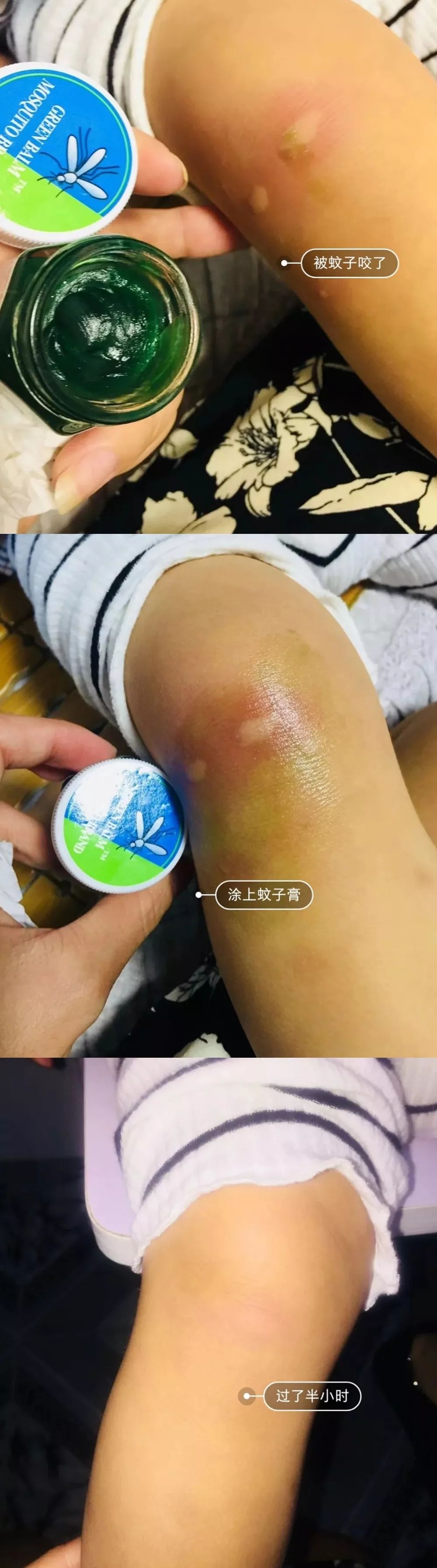 泰国青草膏驱蚊止痒防蚊虫叮咬,泰国蚊子叮咬止痒膏