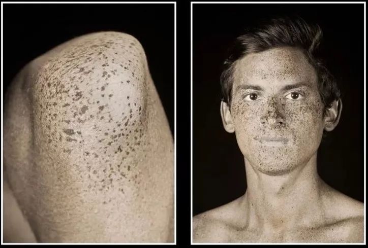 这个举动竟决定你的颜值！一组图震惊所有人：你的皮肤比想象可怕！