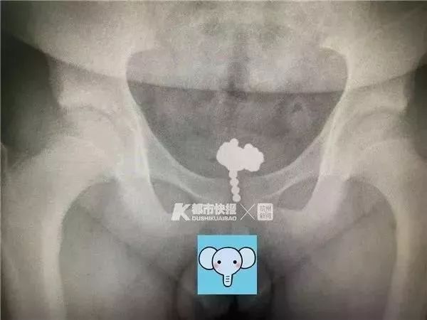 孩子呼吸出来一股恶臭味,三岁女童身体散发臭味真相