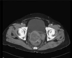 pubmed文献阅读,pubmed综述文献