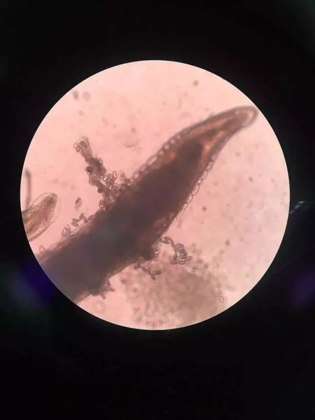 四岁女宝宝说小便地方痒和痛,四岁女宝宝总说小便处痒