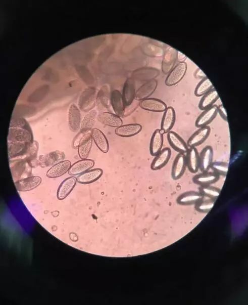 孩子晚上屁股痒要怎么处理,孩子屁股痒如何快速止痒