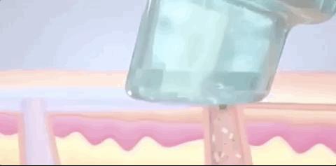 整容明星脸翻车现场,明星整容翻车名场面