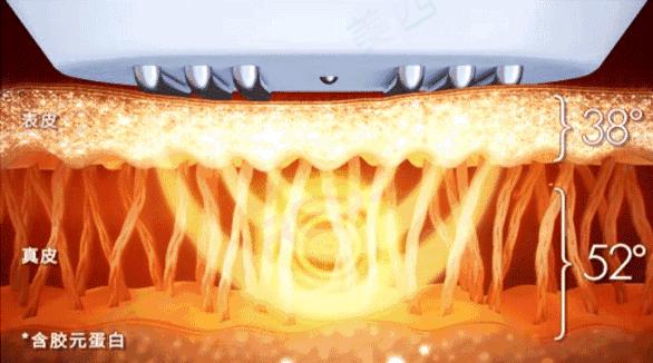 拜托女孩子这个部位千万不能黑！实在太尴尬了