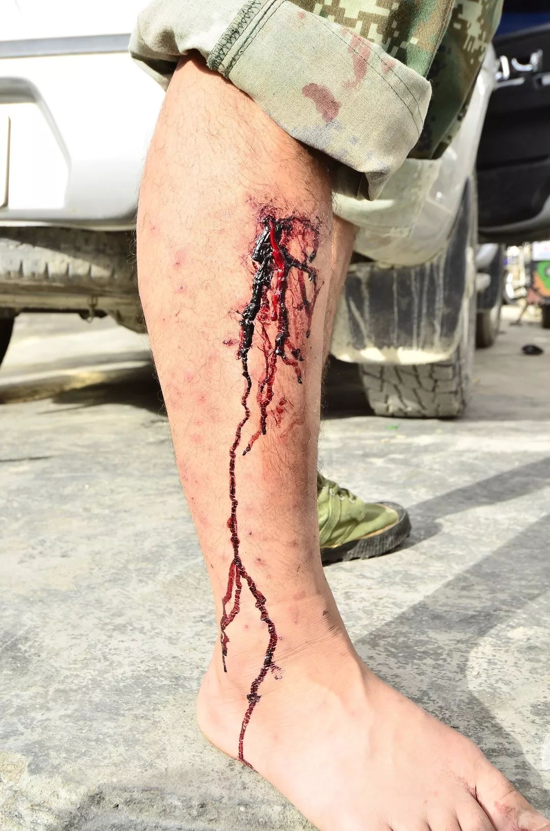 一些吸血的昆虫蜱虫,好多小虫子吸血