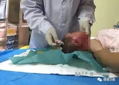 一男子用民间偏方治病险送命！这些偏方都是血淋淋的教训，千万别信